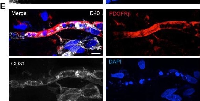 Detection of PDGF R beta  by Immunohistochemistry