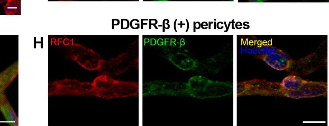 Detection of Mouse PDGF R beta  by Immunohistochemistry