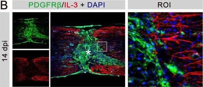 Detection of PDGF R beta  by Immunohistochemistry
