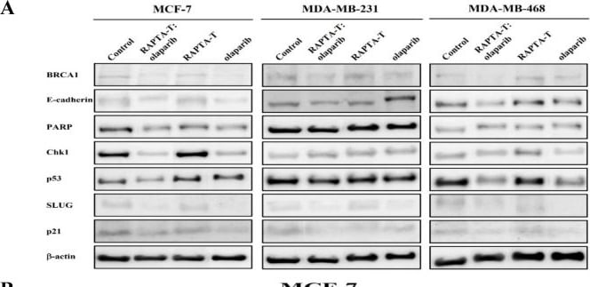 Detection of p21/CIP1/CDKN1A by Western Blot