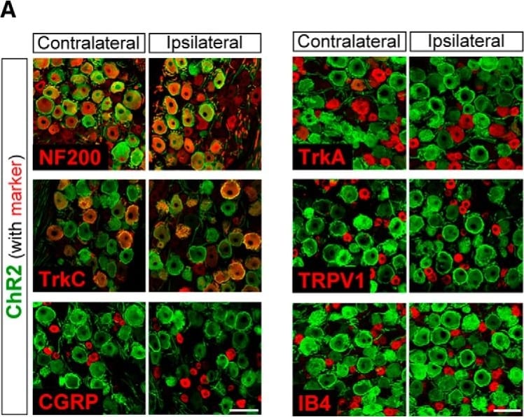 Detection of Rat TrkA by Immunohistochemistry