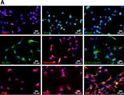 Detection of Notch-1 by Immunocytochemistry/ Immunofluorescence