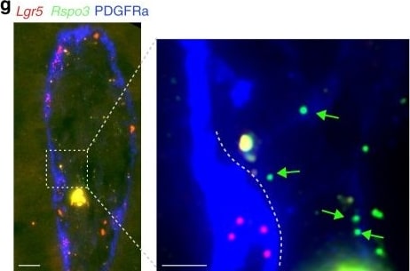 Detection of Mouse PDGF R alpha by Immunocytochemistry/Immunofluorescence.