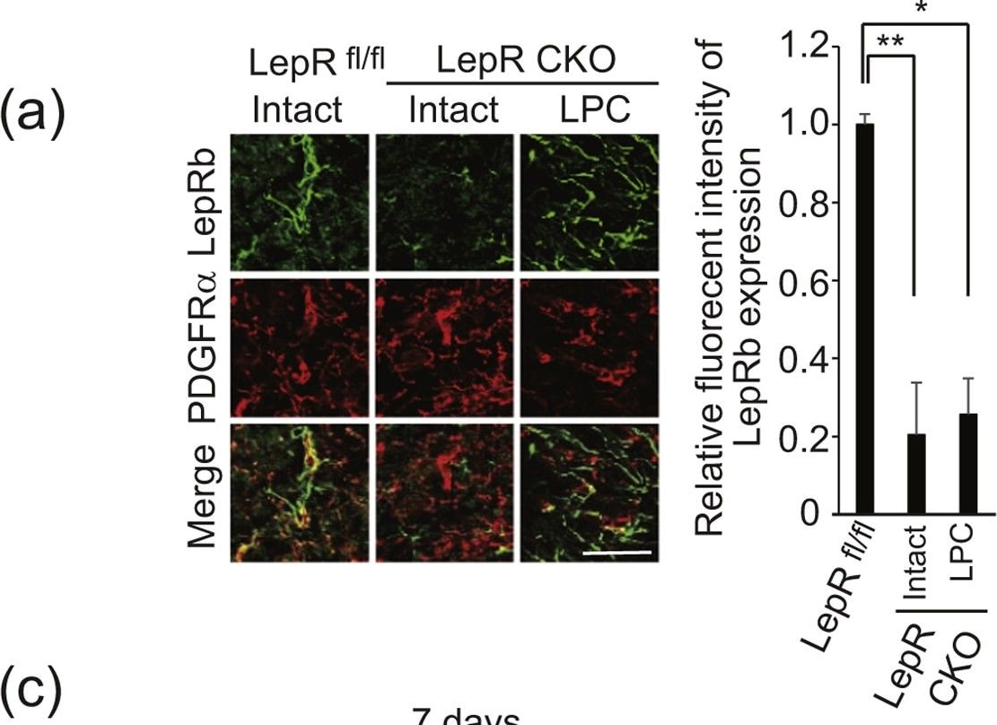 Detection of Mouse PDGF R alpha by Immunocytochemistry/Immunofluorescence.