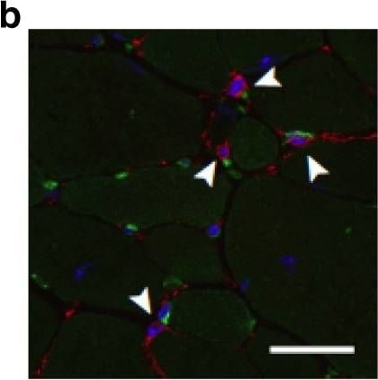 Detection of Mouse PDGFR alpha by Immunocytochemistry/Immunofluorescence