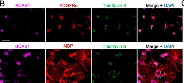 Detection of Rat PDGFR alpha by Immunocytochemistry/Immunofluorescence