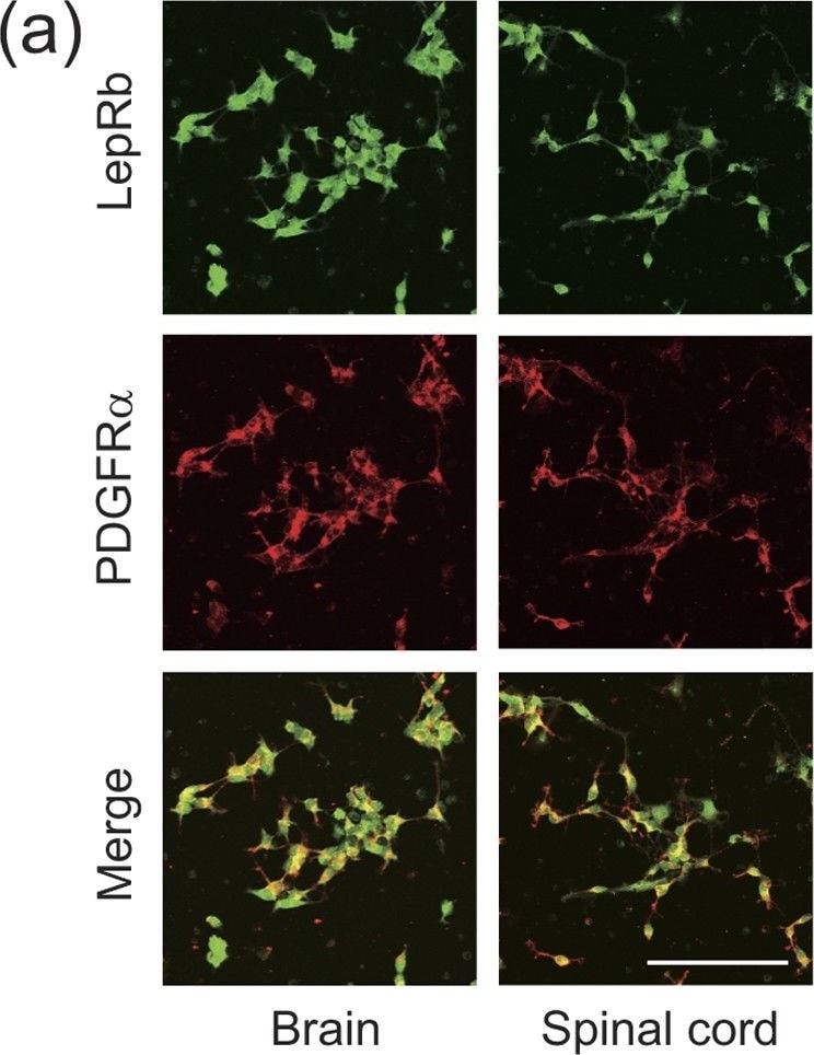 Detection of Mouse PDGFR alpha by Immunocytochemistry/Immunofluorescence