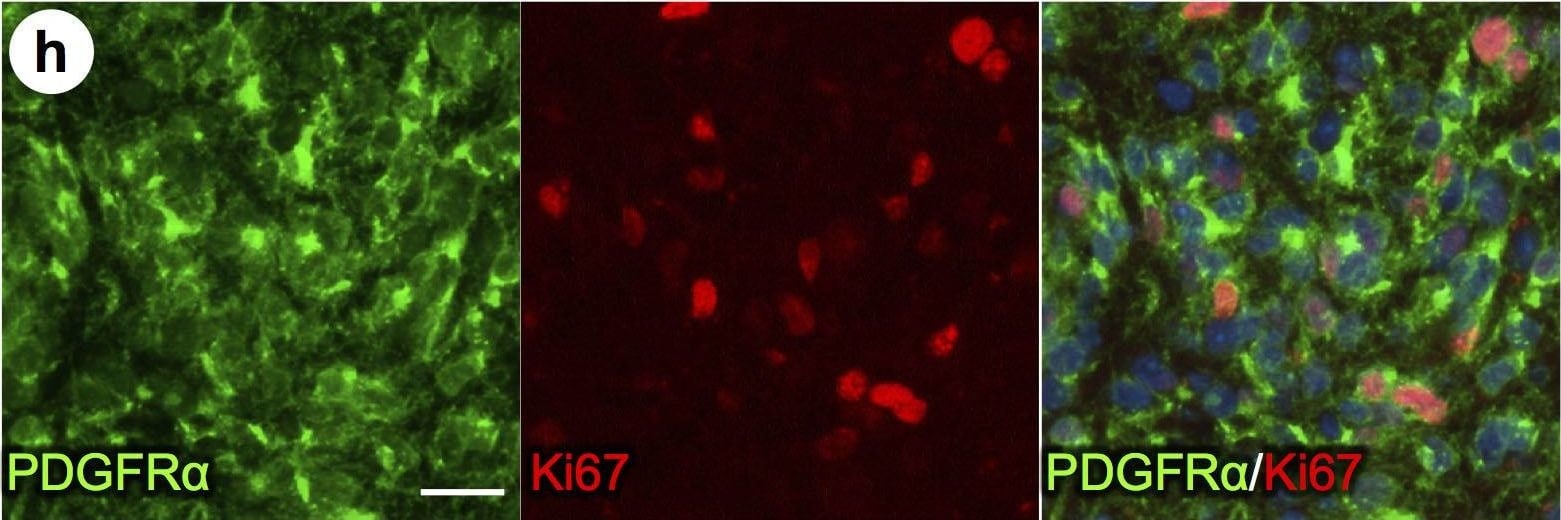 Detection of Mouse PDGFR alpha by Immunohistochemistry