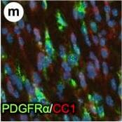 Detection of Mouse PDGFR alpha by Immunohistochemistry