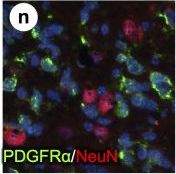 Detection of Mouse PDGFR alpha by Immunohistochemistry
