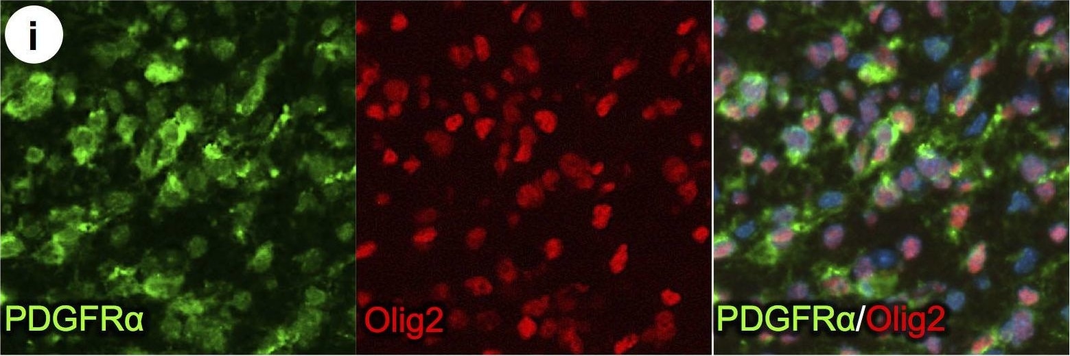 Detection of Mouse PDGFR alpha by Immunohistochemistry