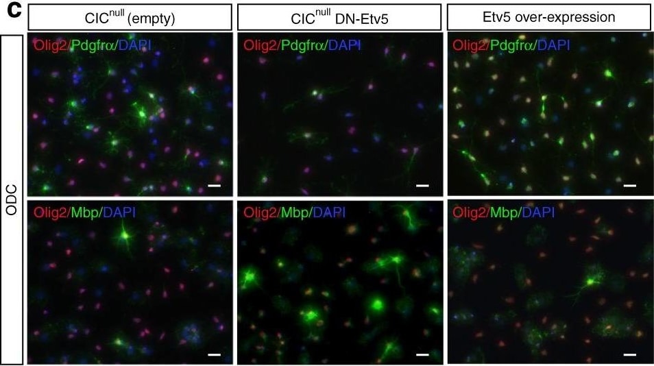 Detection of Mouse PDGFR alpha by Immunocytochemistry/Immunofluorescence