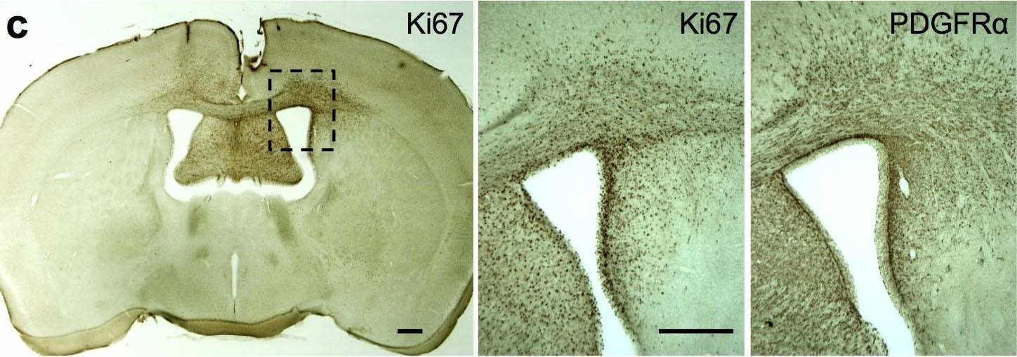 Detection of Mouse PDGFR alpha by Immunohistochemistry