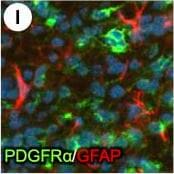 Detection of Mouse PDGFR alpha by Immunohistochemistry