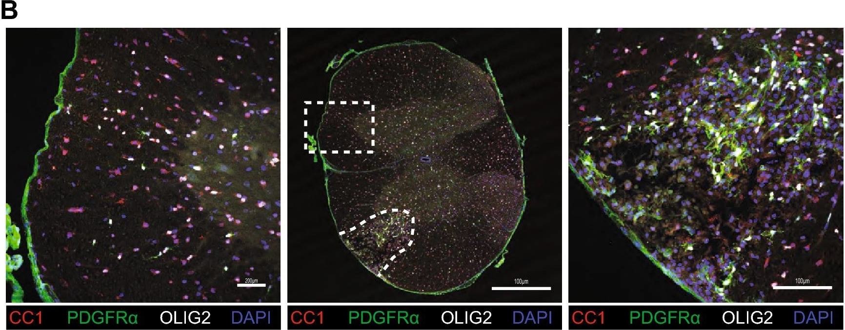 Detection of Mouse PDGFR alpha by Immunohistochemistry