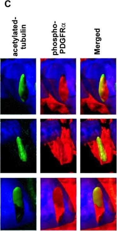 Detection of Mouse PDGFR alpha by Immunohistochemistry