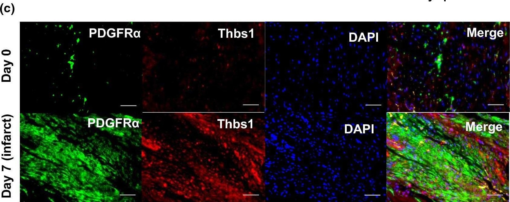 Detection of Mouse PDGF R alpha by Immunohistochemistry