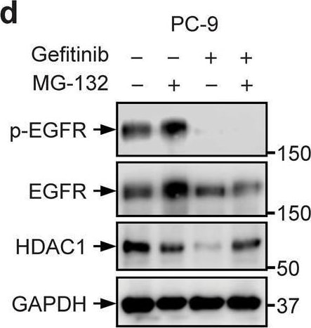 Detection of Human Phospho-EGFR (Y1173) by Western Blot