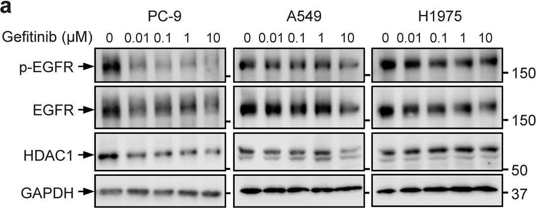 Detection of Human Phospho-EGFR (Y1173) by Western Blot