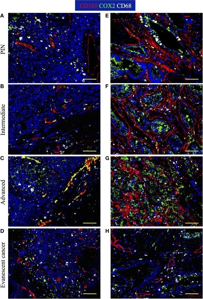 Detection of Human Endoglin/CD105 by Immunocytochemistry/Immunofluorescence