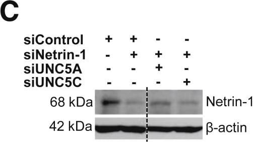 Detection of Human Netrin-1 by Western Blot
