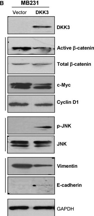 Detection of Human Dkk-3 by Western Blot