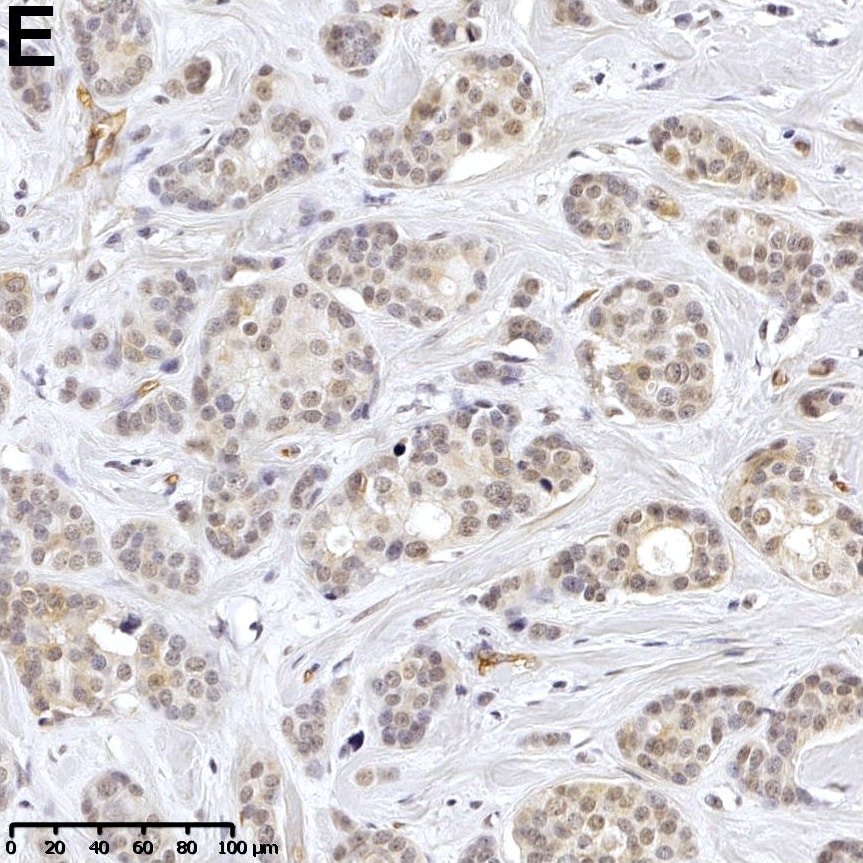 Detection of Human Dkk-3 by Immunohistochemistry