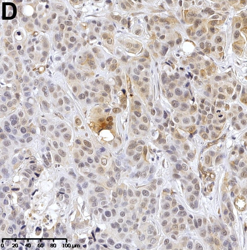 Detection of Human Dkk-3 by Immunohistochemistry
