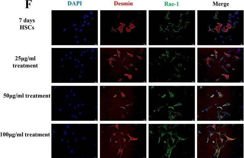 Detection of Rae-1 Pan Specific by Immunocytochemistry/ Immunofluorescence