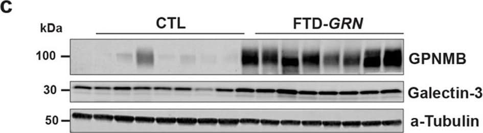 Detection of Human Galectin-3 by Western Blot