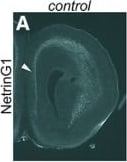 Detection of Mouse Netrin-G1a by Immunohistochemistry