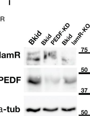 Detection of Serpin F1/PEDF by Western Blot