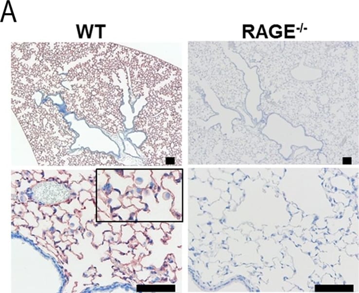 Detection of Mouse AGER by Immunohistochemistry