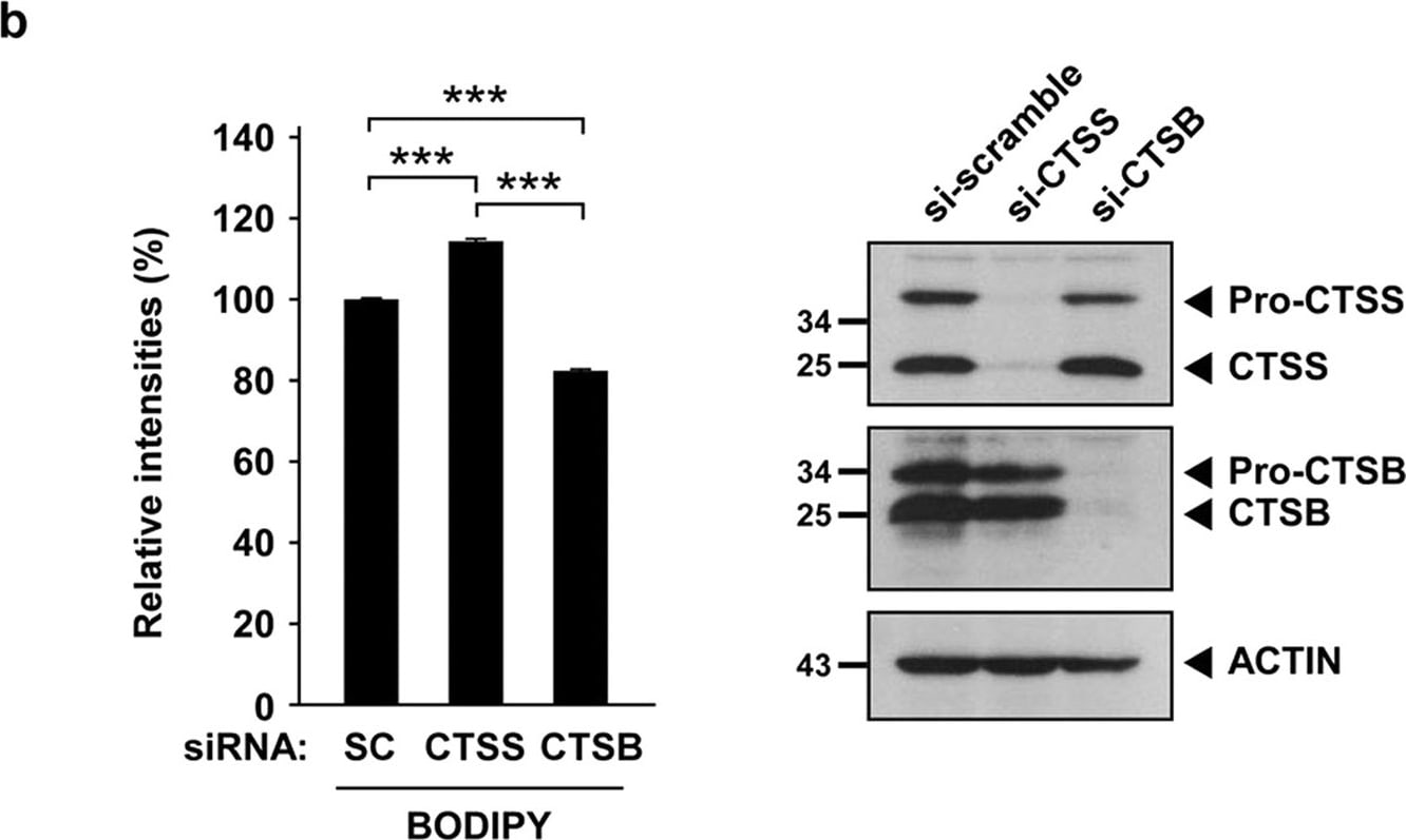 Detection of Human Cathepsin S by Western Blot