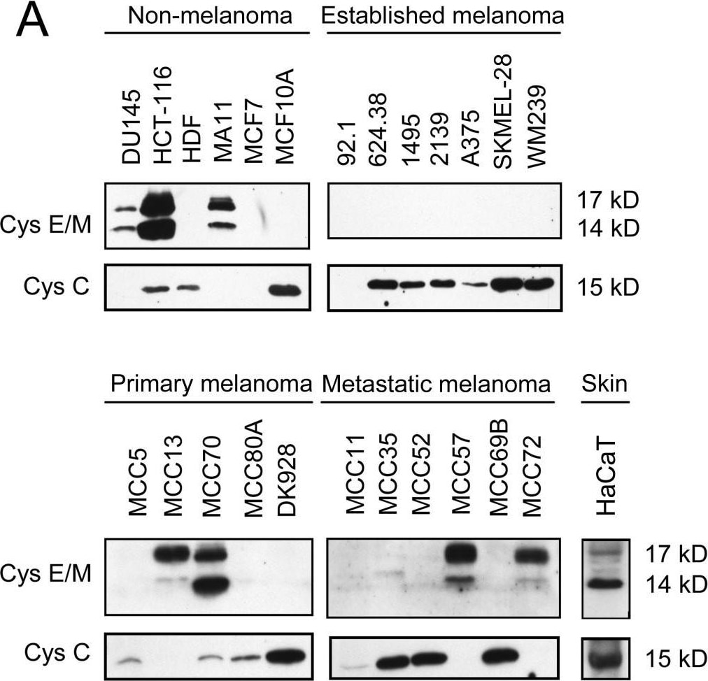Detection of Human Cystatin C by Western Blot