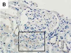 Detection of Human TWEAK R/TNFRSF12 by Immunohistochemistry-Paraffin