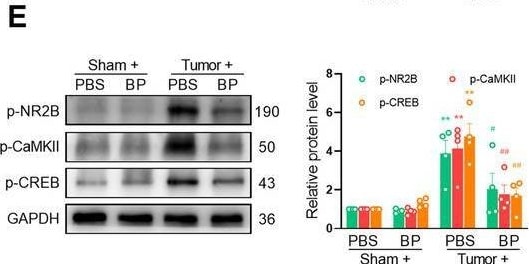 Detection of IL-18 BPa by Western Blot
