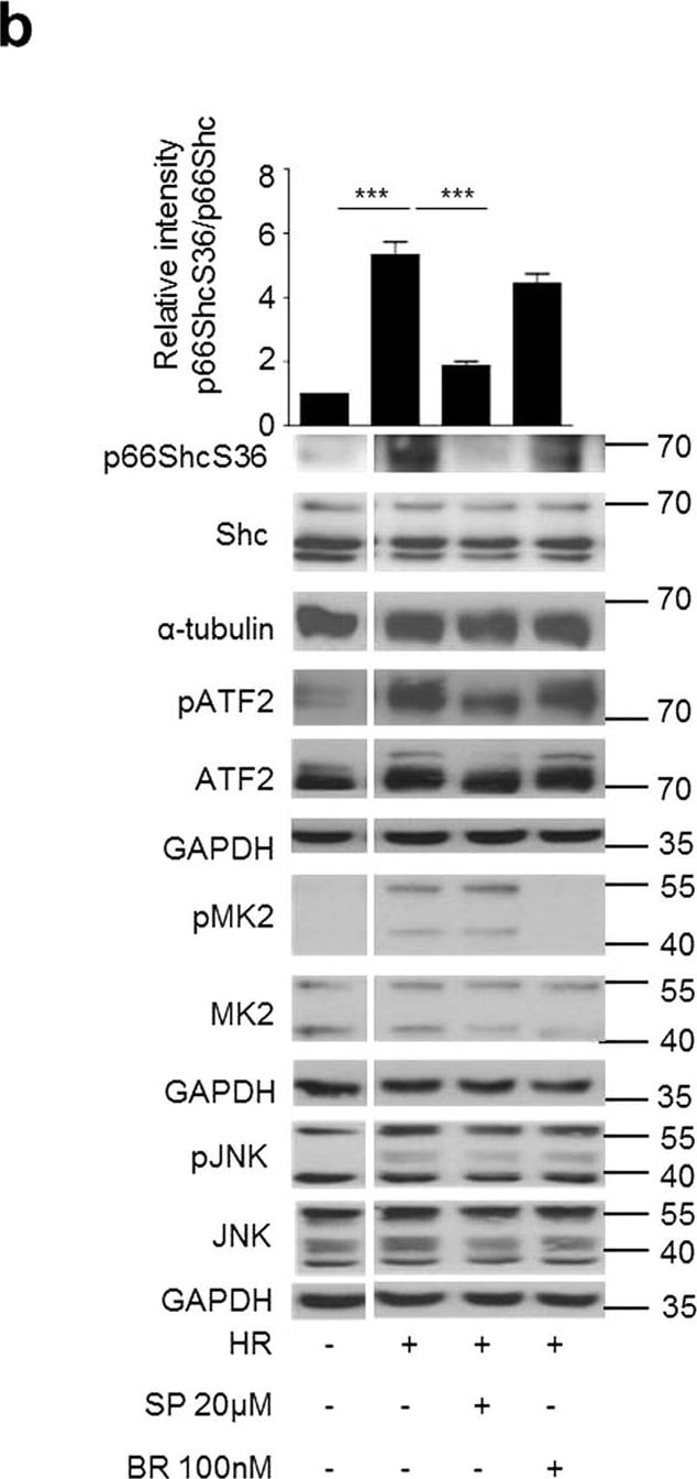 Detection of Mouse JNK1/2/3 by Western Blot