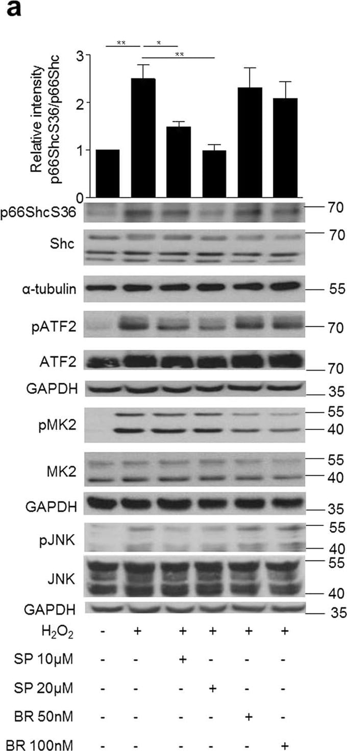 Detection of Mouse JNK1/2/3 by Western Blot