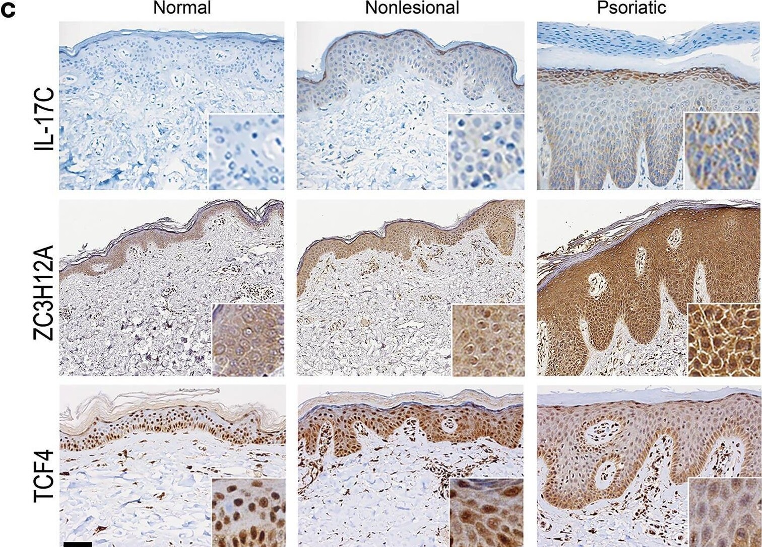Detection of IL-17C by Immunohistochemistry