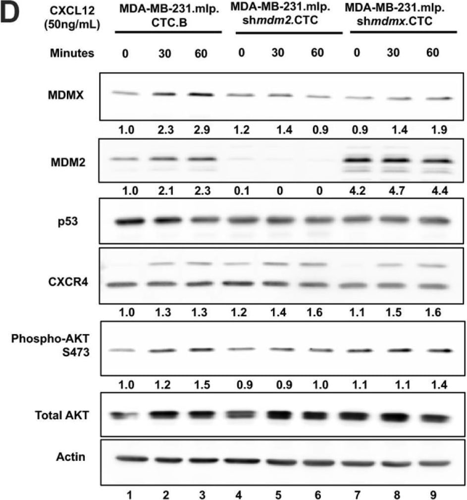 Detection of MDM2/HDM2 by Western Blot