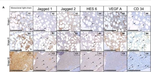 Detection of Jagged 1 by Immunohistochemistry