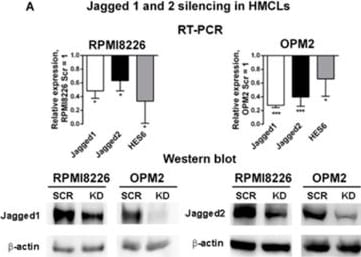 Detection of Jagged 1 by Western Blot