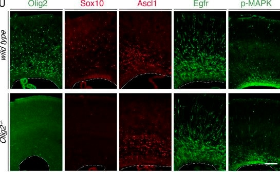 Detection of EGFR by Immunohistochemistry