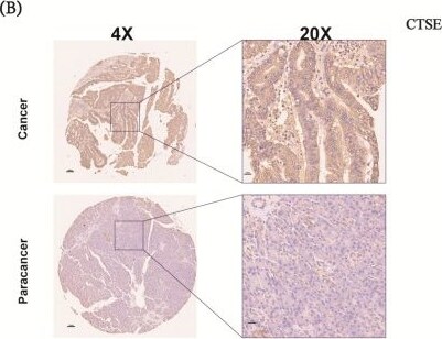 Detection of Cathepsin E by Immunohistochemistry