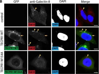 Detection of Galectin-8 by Immunocytochemistry/ Immunofluorescence