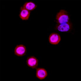 beta -Catenin antibody in SW480 Human Cell Line by Immunocytochemistry (ICC).