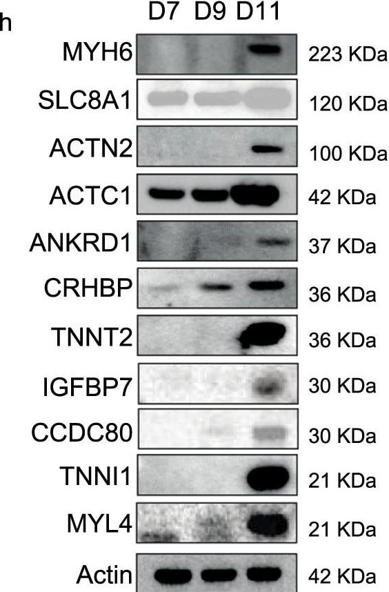 Detection of IGFBP-rp1/IGFBP-7 by Western Blot