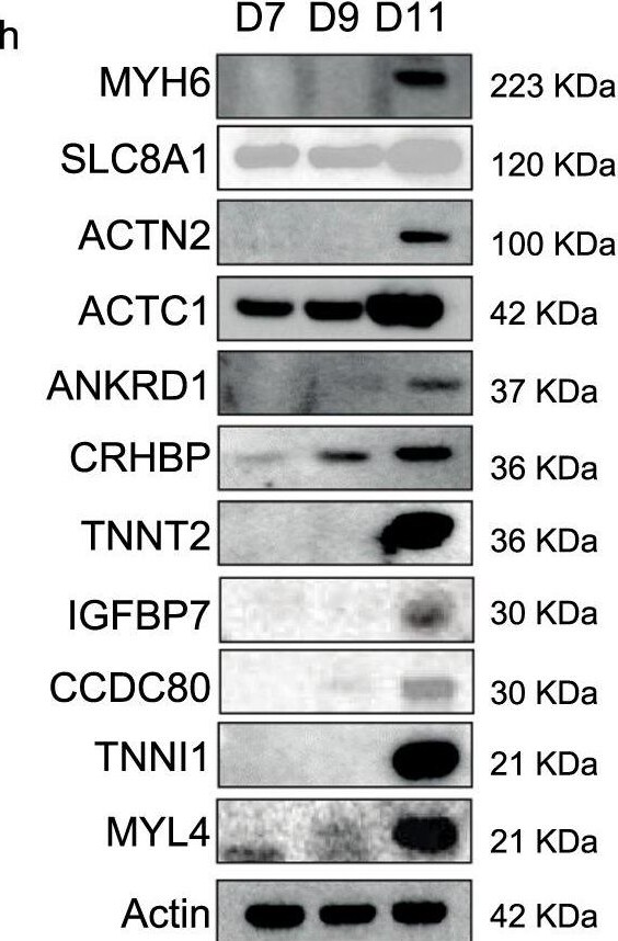 Detection of IGFBP-rp1/IGFBP-7 by Western Blot