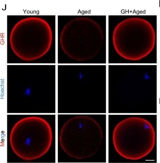 Detection of Growth Hormone R (GHR) by Immunocytochemistry/ Immunofluorescence